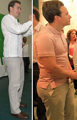 Velasco se opero el derriere 3