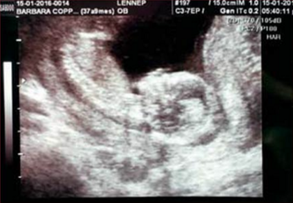 Coppel confirma el sexo Coppel confirma el sexo